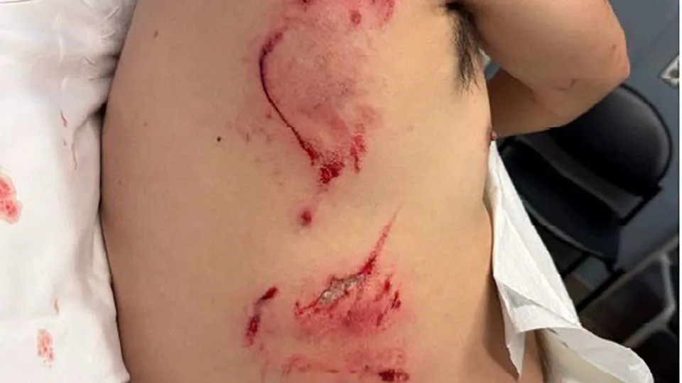 Sen. Patty Murray Demands Release After Man Bitten by Patrol Dog During CBP Detention in Vancouver, Washington - Image 1