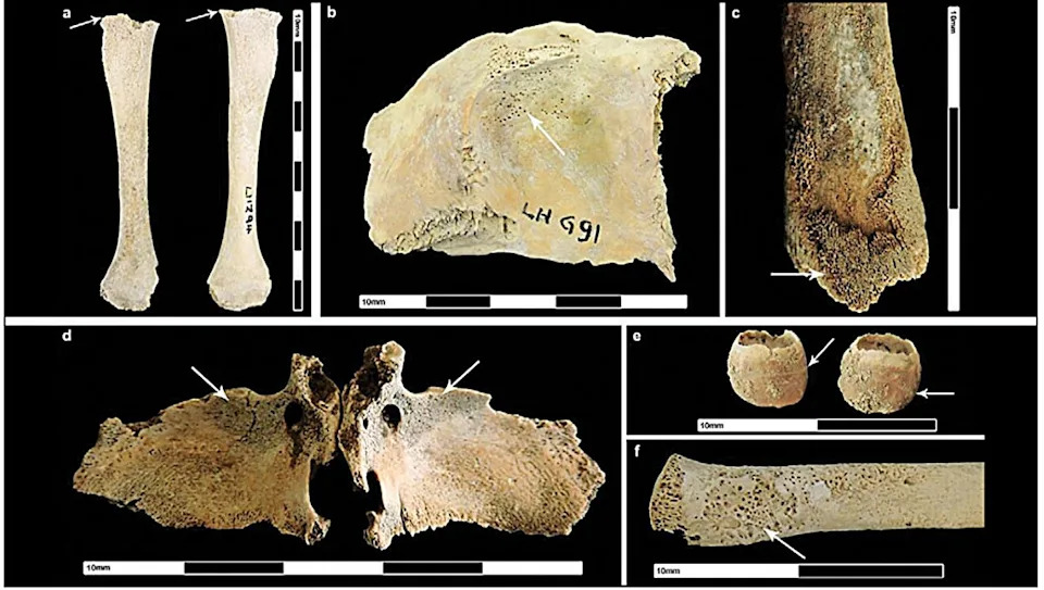Roman Rule Worsened Urban Health in Britain, Study Finds — Infants Reveal Lasting Impact - Image 1
