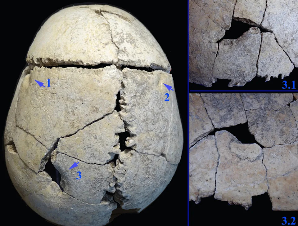 Teen Survived Lion Mauling 6,200 Years Ago, Skull Shows — But Wounds Likely Proved Fatal - Image 1
