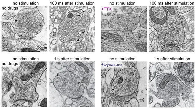 Zap-and-Freeze Captures Millisecond Synaptic Events — Could Shed Light On Parkinson's - Image 1