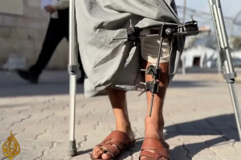 Gaza Doctors Use Solar-Powered 3D Printing To Save Limbs From Amputation - Image 2