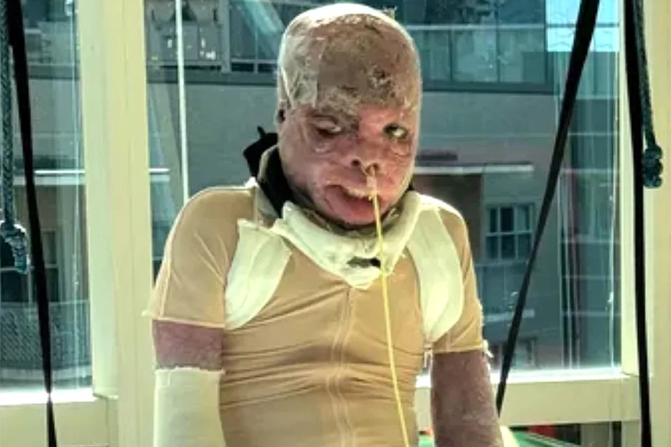 ‘He’s Home’: 10-Year-Old Burn Survivor From Philadelphia Learjet Crash Returns After 42 Surgeries - Image 1