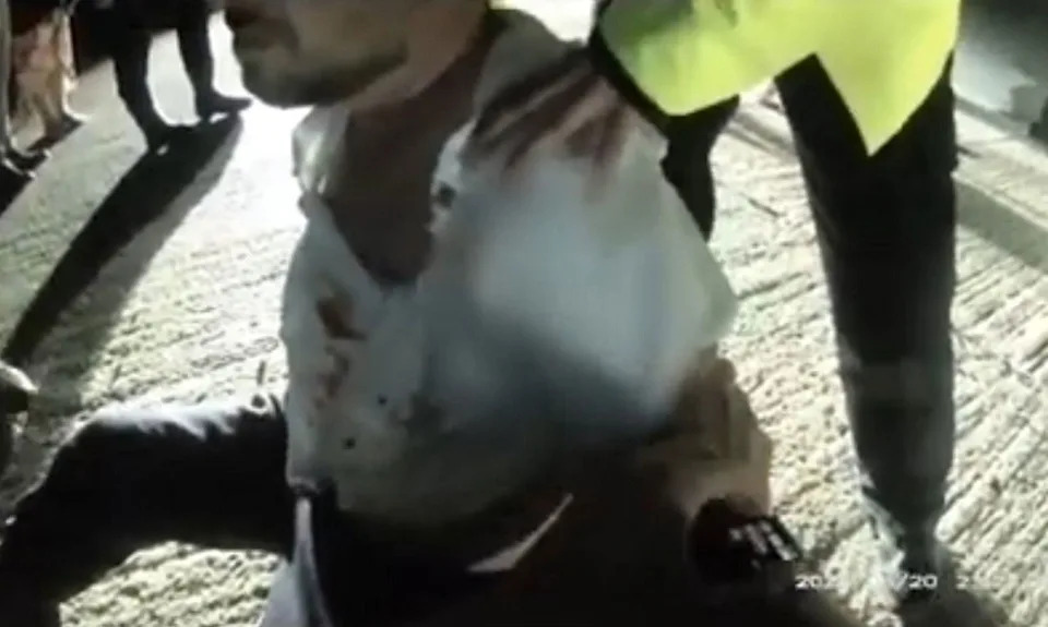 Wedding Usher Sentenced to 5 Years After Biting Off Groom’s Uncle’s Finger - Image 1