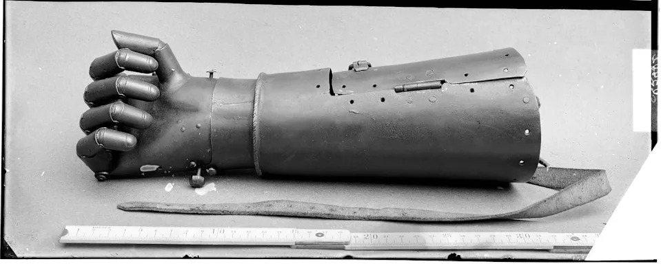 From Saws to ‘Bionic’ Iron Hands: How Renaissance Amputation Reimagined the Human Body - Image 4