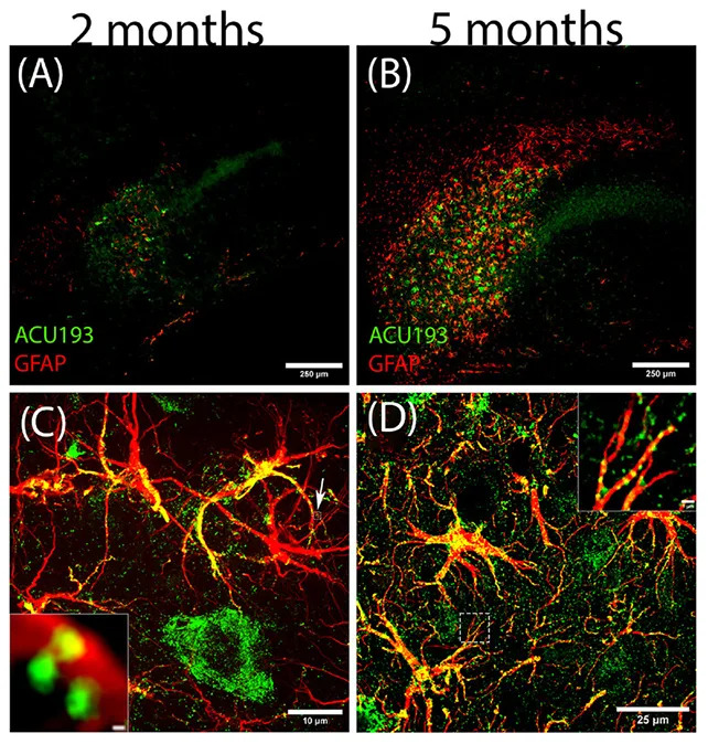 NU-9 Slows Early Alzheimer’s Changes in Mice and Reveals New Toxic Oligomer ACU193+ - Image 1