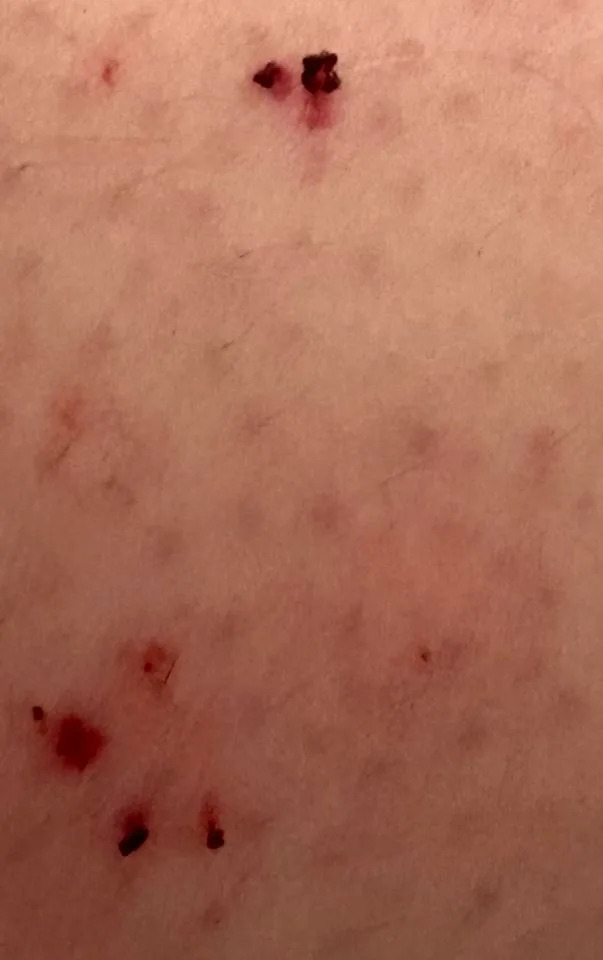 Eastern Brown Snake Latched To Woman's Sneaker During Sydney Geocache — She Was Treated For Suspected Bites - Image 2