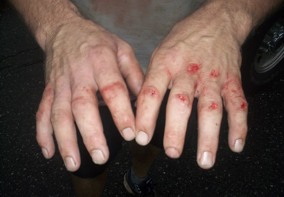 Widower Seeks Retrial After Controversial Pipe-Through-Windshield Death; New Evidence Shakes Case