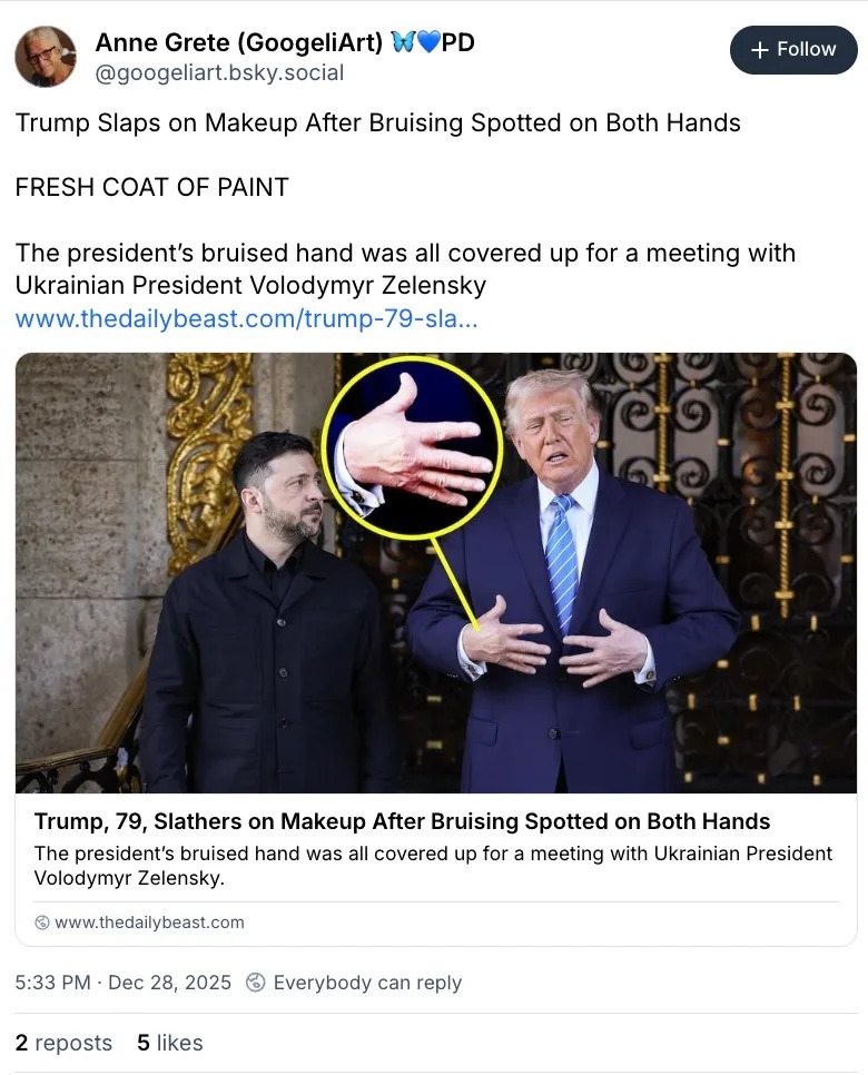 ‘Painted’ Hands? Trump’s Hands Ignite Social Media Buzz After Mar‑a‑Lago Meeting With Zelensky