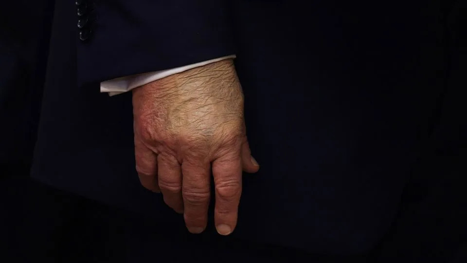 Aspirin, CT Scan and Little Sleep: Five Medical Questions Raised by Trump’s Latest Health Disclosures