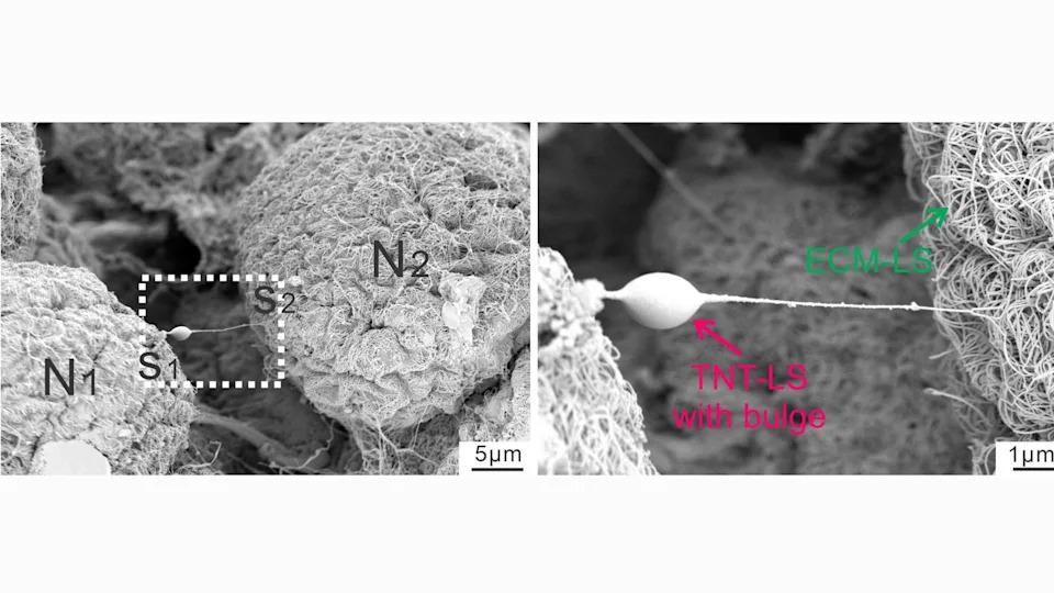 Glial Cells Can Donate Mitochondria To Sensory Nerves — A New Path To Treat Chronic Pain
