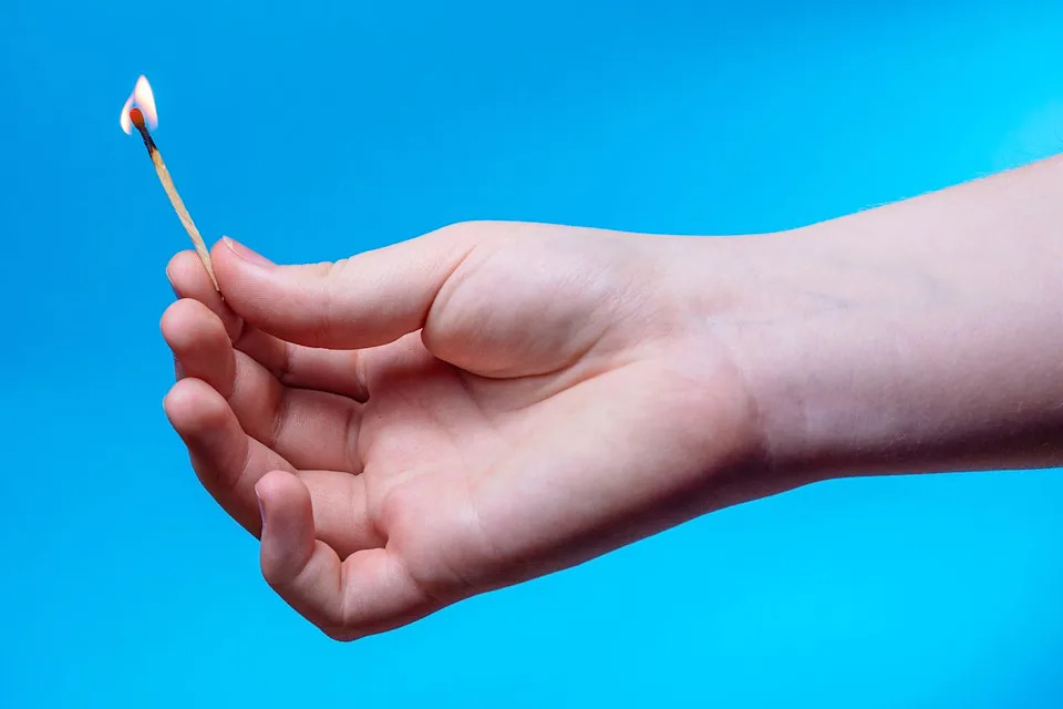 Chicago Mom Warns After Daughter Suffers Severe Burns in Viral “Fire Challenge”