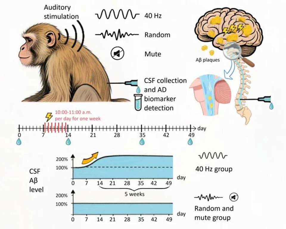 40Hz Sound Stimulation Clears Toxic Alzheimer’s Proteins in Aged Monkeys — A Potential Low-Cost, Noninvasive Therapy