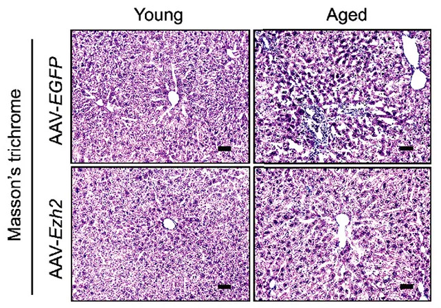 Blueprint to Revive Old Cells: Four Transcription Factors Shift Cells Toward Youth