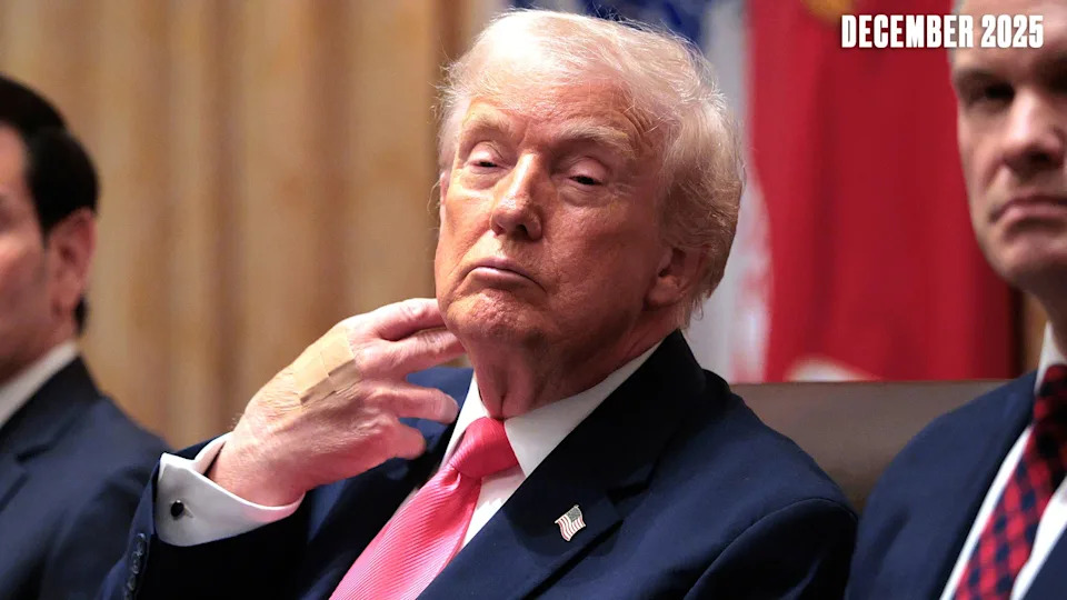 White House Labels Daily Beast Reporter 'Mentally Ill' After Questioning Trump's Bruised Hand — Media Scrutiny Intensifies