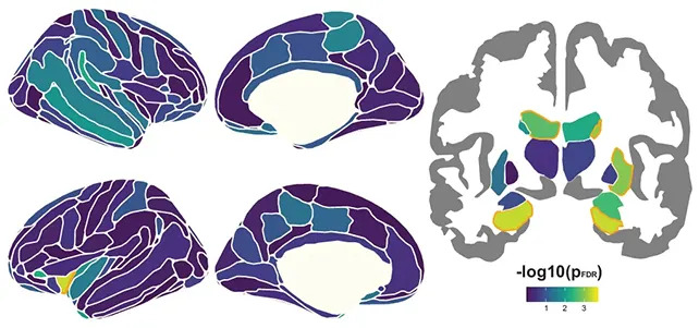 10,000 Brain Scans Reveal Why Episodic Memory Worsens With Age — And What Might Help