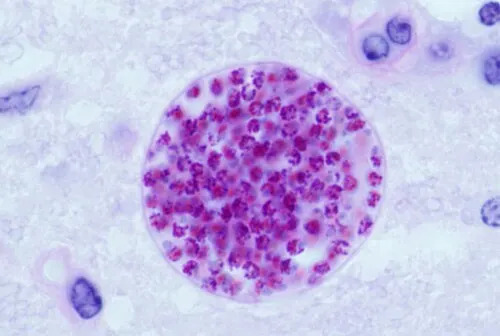 Brain Parasite Thought Dormant Shows Multiple Active Forms — New Study Changes How We Fight Toxoplasma