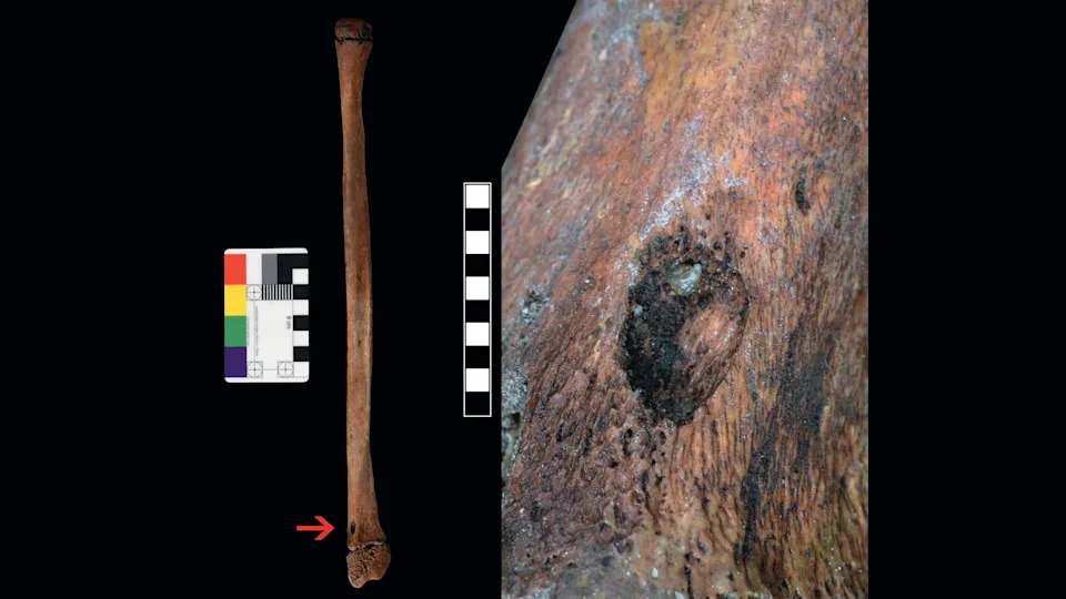 28,000-Year-Old Teen Buried After Bear Mauling, New Skeletal Analysis Shows