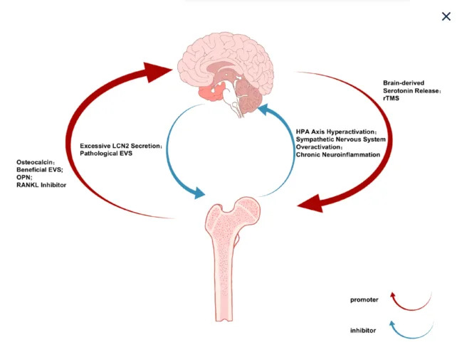 New Research Highlights a 'Bone–Brain Axis' That May Link Depression and Osteoporosis