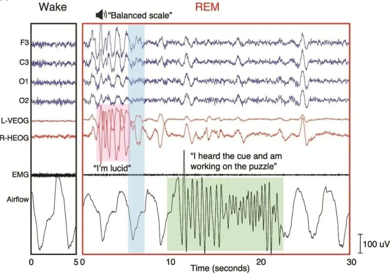 Usmereni snovi u REM fazi mogu udvostručiti šanse za rešavanje zagonetki