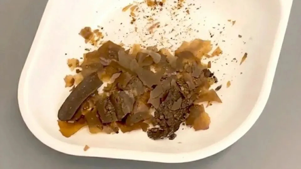 Prvi arheološki dokaz da su Rimljani koristili ljudski izmet kao lek