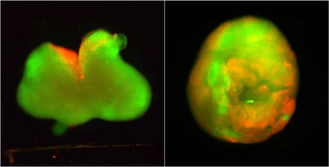 Naučnici Uzgajili Mini Ljudske Kičmene Moždine — Terapija IKVAV-PA Podstiče Regeneraciju Posle Povrede