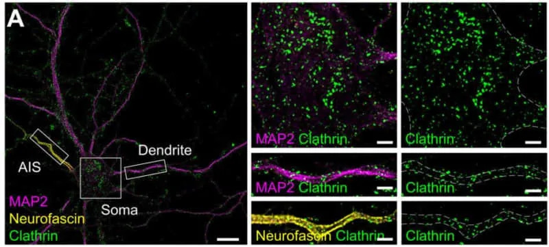 „Vratar” Ispod Membrane: Kako Rešetka Neurona Može Smanjiti Rizik Od Alchajmera
