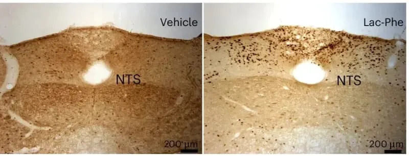 Znojenje Koje Utišava Glad: Molekul Lac‑Phe Smanjuje Apetit Kod Miševa