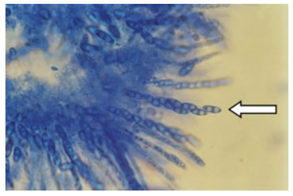 Kafa Ugrožena: Fusarium Koristi 