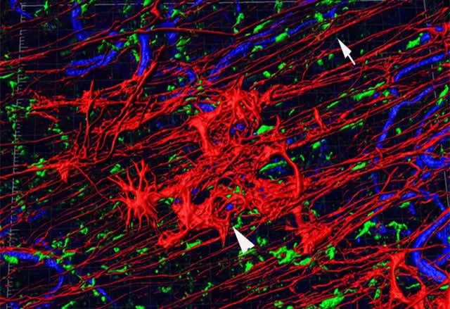 Periferna retina može otkriti Alchajmer ranije — studija na miševima otkriva rane ćelijske promene