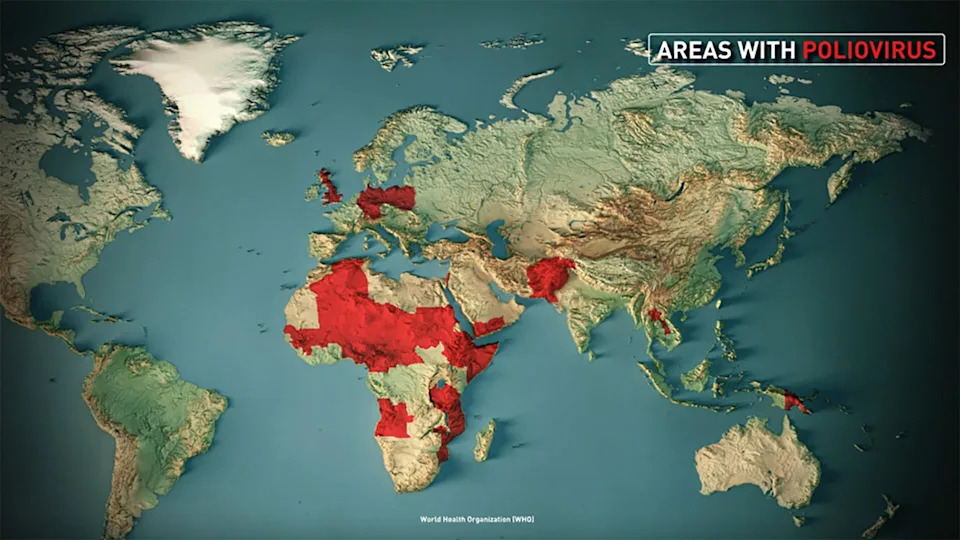 How Safe Is the U.S. From Polio? Why Vaccination Still Matters