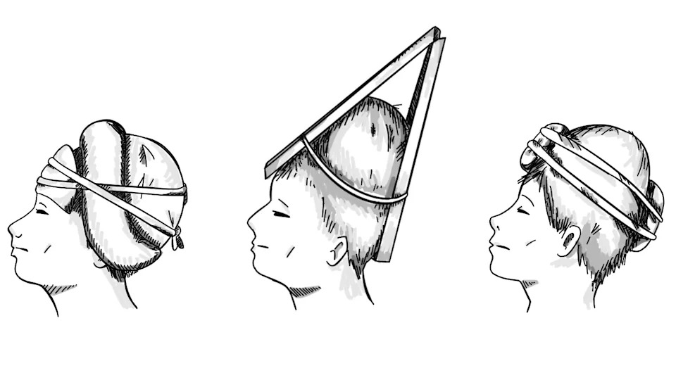 Zašto su ljudi širom sveta oblikovali bebina lica? Tajne kranijalne modifikacije