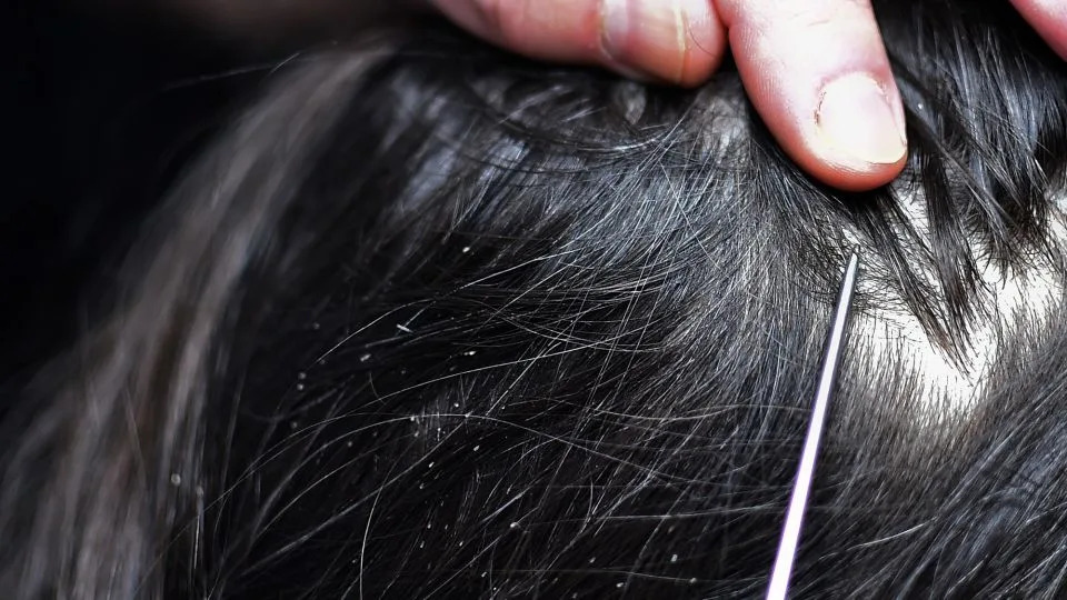 Komarci i ljudska krv: DNK otkriva kada su hominini stigli u Sundaland pre 2,9–1,6 miliona godina