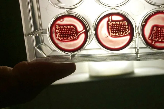 Otkriven Receptor Koji Može Ojačati Kosti — Moguć Put Ka Lečenju Osteoporoze