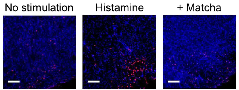 Može Li Šolja Matcha Čaja Zaustaviti Kijanje? Japanska Studija Donosi Neočekivane Nalaze