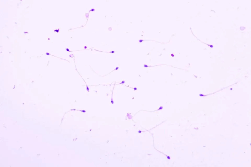 Može Li Kontraceptivna Vakcina IZUMO1 Rešiti Problem Prekomernih Populacija Životinja?