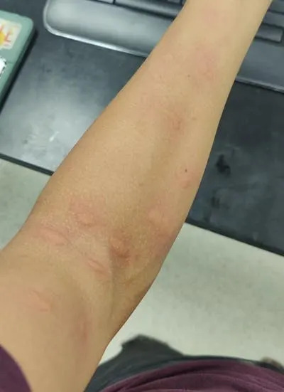 Kako Nas Komarci Pronalaze: Georgia Tech, Student-Volonter i Model Na 20 Miliona Podataka