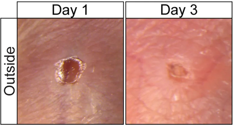 Otkriveno kako sprečiti ožiljke: blokiranje Cxcl12 vraća regeneraciju kože kod miševa