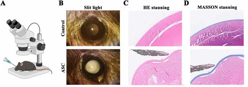 Zašto se pojavljuju ožiljci posle operacije katarakte? Novi uvid u ulogu NR2F1 i STAT3