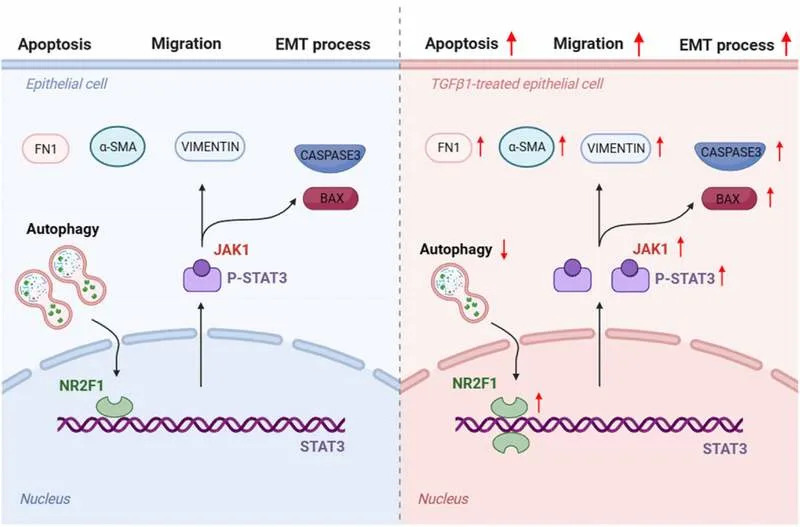 Zašto se pojavljuju ožiljci posle operacije katarakte? Novi uvid u ulogu NR2F1 i STAT3