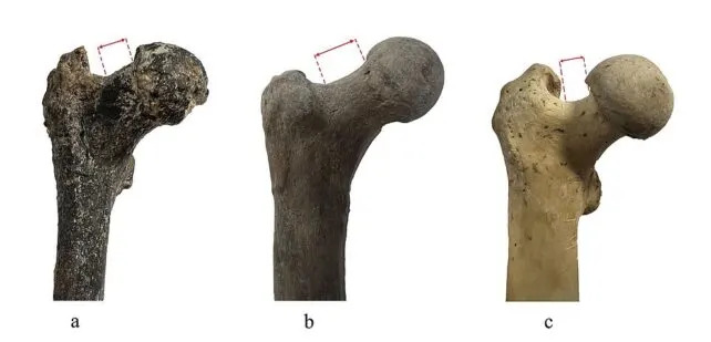 Femur Star 7,2 Miliona Godina Iz Bugarske: Da Li Je Graecopithecus Bio Rani Hominin?