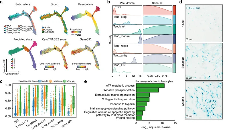 Novo istraživanje otkriva zašto povrede rotatorne manžetne ostavljaju dugotrajne ožiljke — moguće nove terapije
