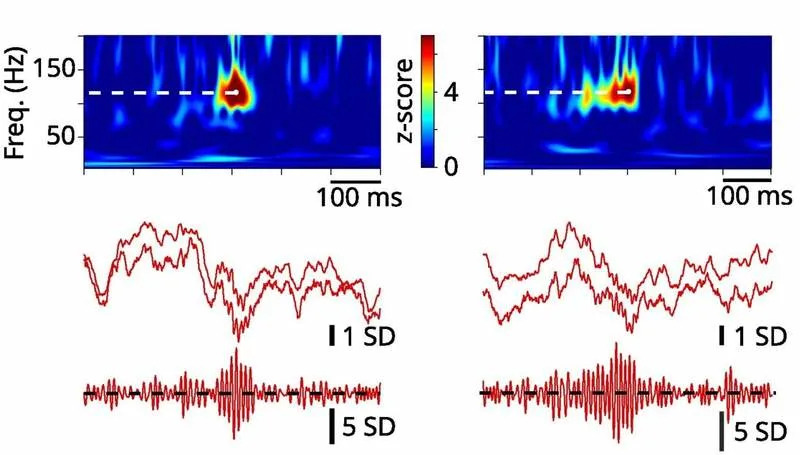 Jedan Kratak Trening Može Brzo Promeniti Kako Mozak Pamti