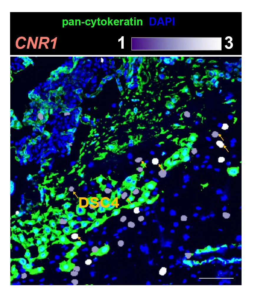 Otkriven Novi Tip Ćelije Koja Se Pojavljuje Samo Tokom Trudnoće — Novi Atlas Posteljice Otkriva Vezu Sa Kanabinoidima
