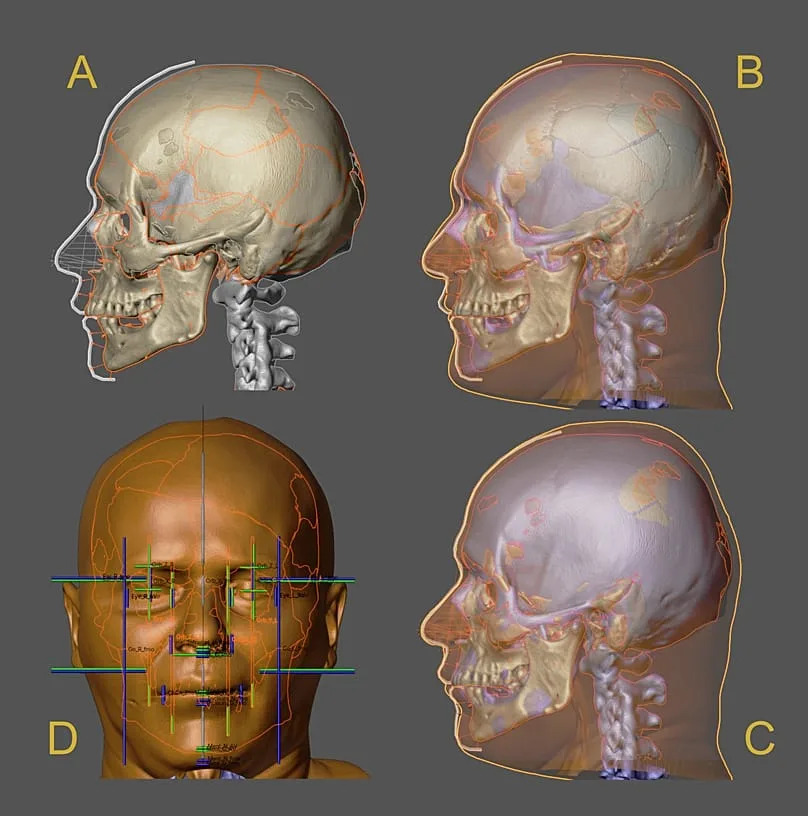 Iz Groba 'Vampira': Arheolozi U Hrvatskoj Rekonstruisali Lice Muškarca Starog Više Od 400 Godina