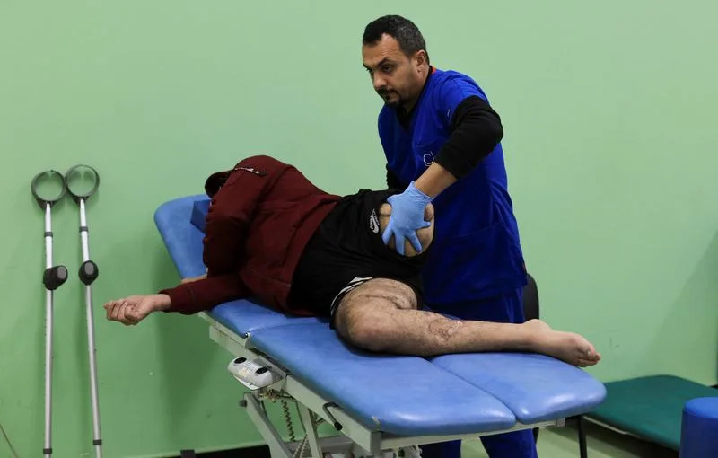 Hitno: U Gazi Nedostaju Proteze — Skoro 5.000 Amputiraca, Deca Najugroženija