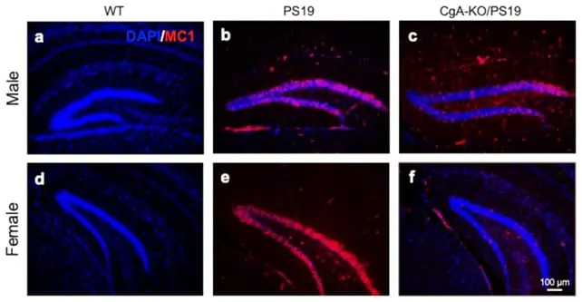 Otkriven Protein Koji Može Štititi Mozak Od Simptoma Alchajmerove Bolesti