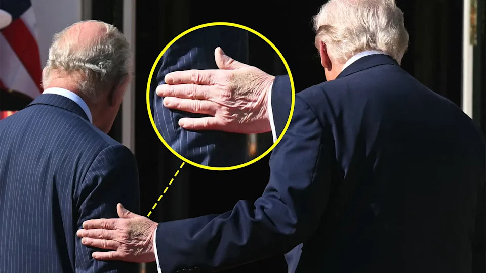 Photos Capture President Trump’s Swollen Ankles During Oval Office Meeting With King Charles III