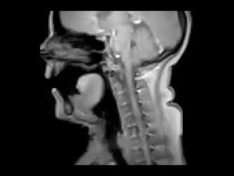 MRI Otkriva Neočekivan Efekat Zijevanja: CSF Se Pomera Od Mozga