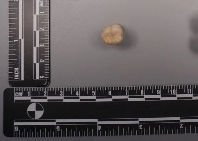 Proteini Stari 400.000 Godina Otkrivaju Genetsko Mešanje Između Homo erectus‑a i Denisovana