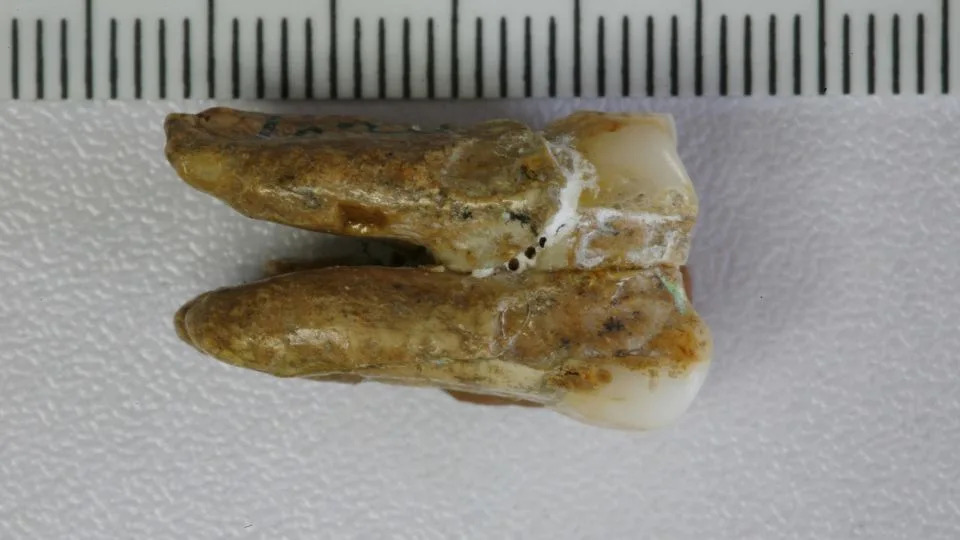 Proteini iz praistorijskih zuba otkrivaju genetske veze između Homo erectus i drugih ljudskih vrsta